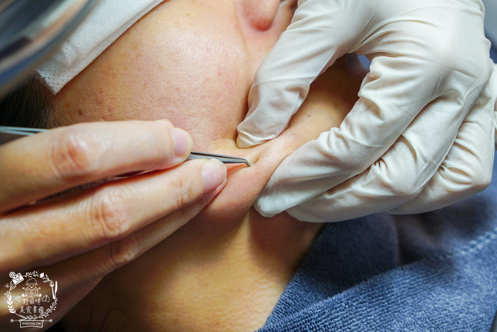 高雄藻針推薦[帥哥美容]讓肌膚深層代謝的精巧保養!高雄美容推薦！