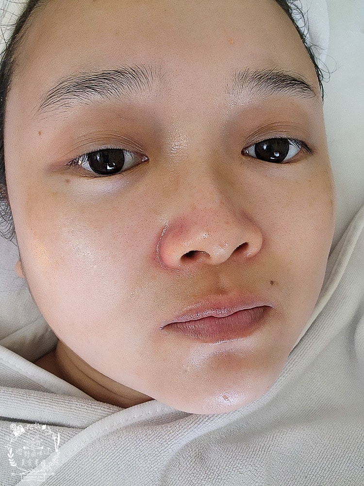 高雄做臉推薦[拾月美容工作室]舒適有感的a-GA1液態飛梭|讀者有八折優惠|高雄美容推薦！