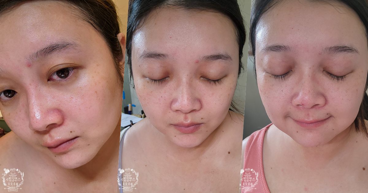 扉珞霓V皙白晶|白皙C晶片科技！餵皮膚吃新鮮的維他命C比口服更容易被吸收！