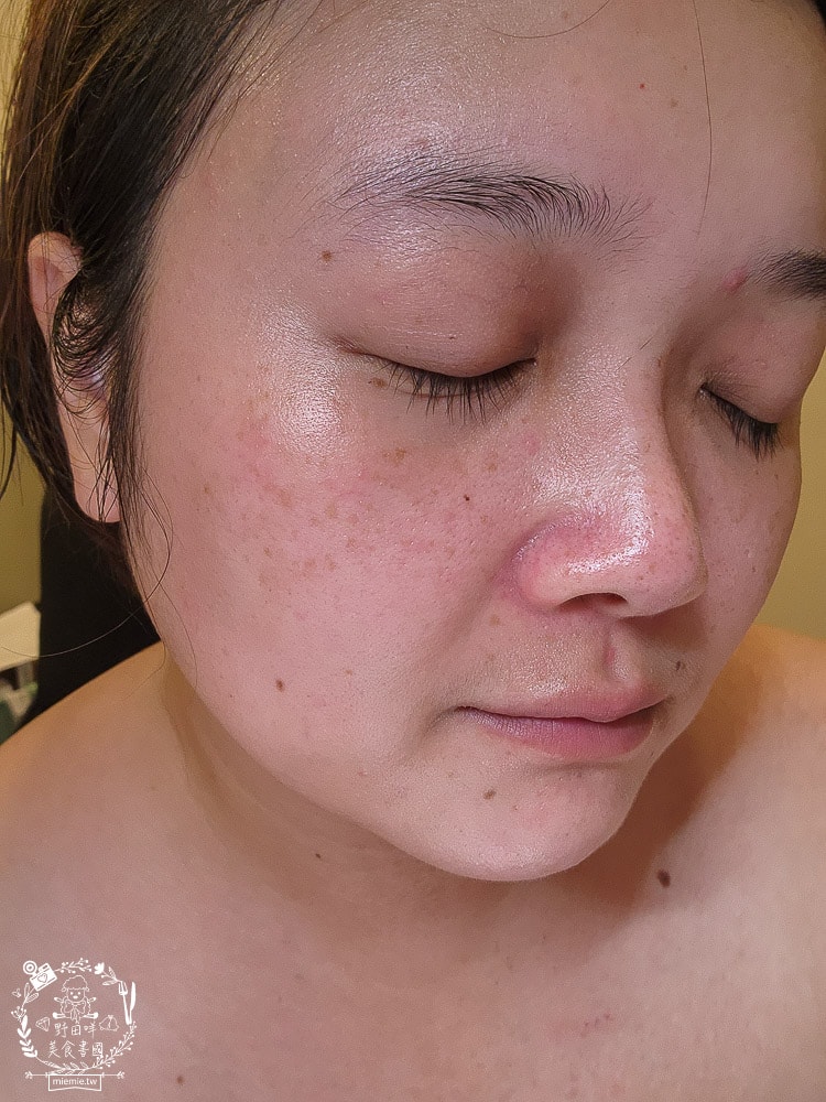 扉珞霓V皙白晶|白皙C晶片科技！餵皮膚吃新鮮的維他命C比口服更容易被吸收！