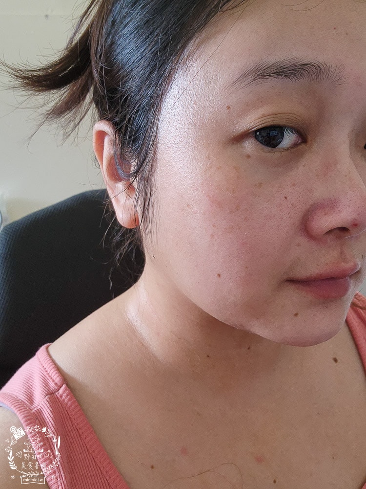 扉珞霓V皙白晶|白皙C晶片科技！餵皮膚吃新鮮的維他命C比口服更容易被吸收！