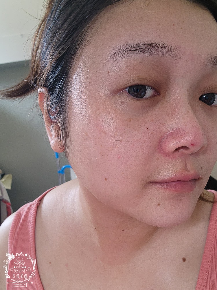 扉珞霓V皙白晶|白皙C晶片科技！餵皮膚吃新鮮的維他命C比口服更容易被吸收！